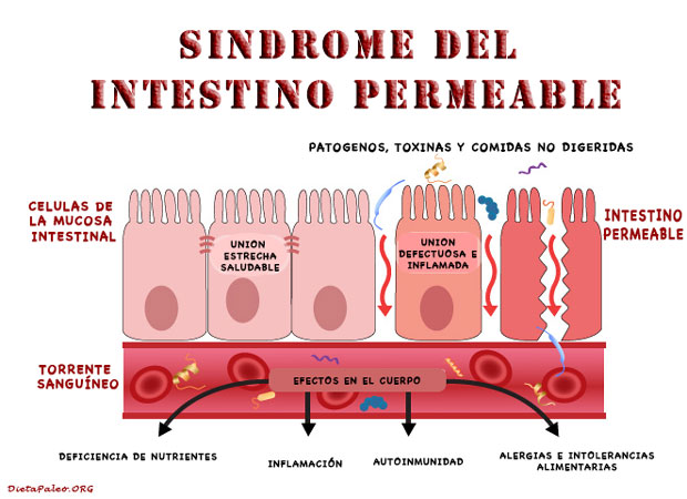 intestino-permeable